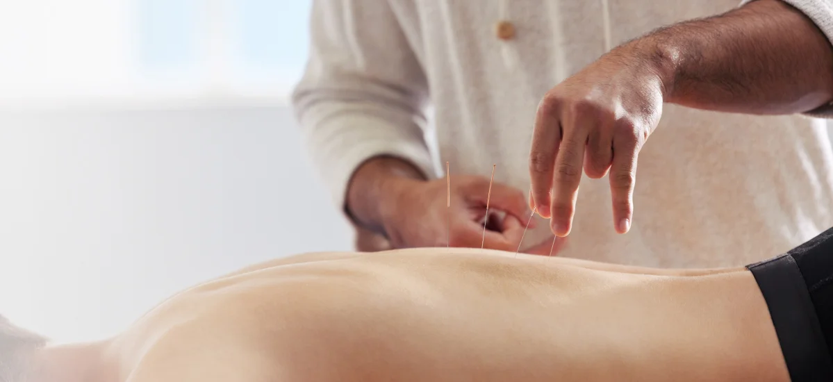 acupuncture sessions for pain