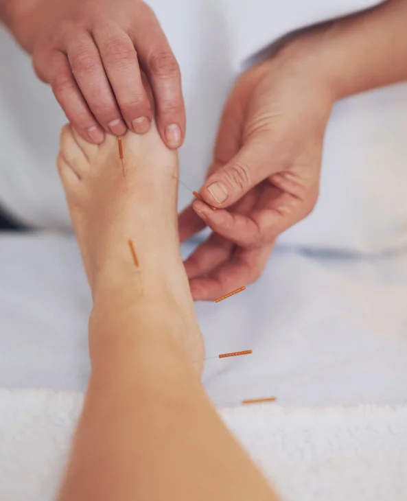 schedule acupuncture treatment